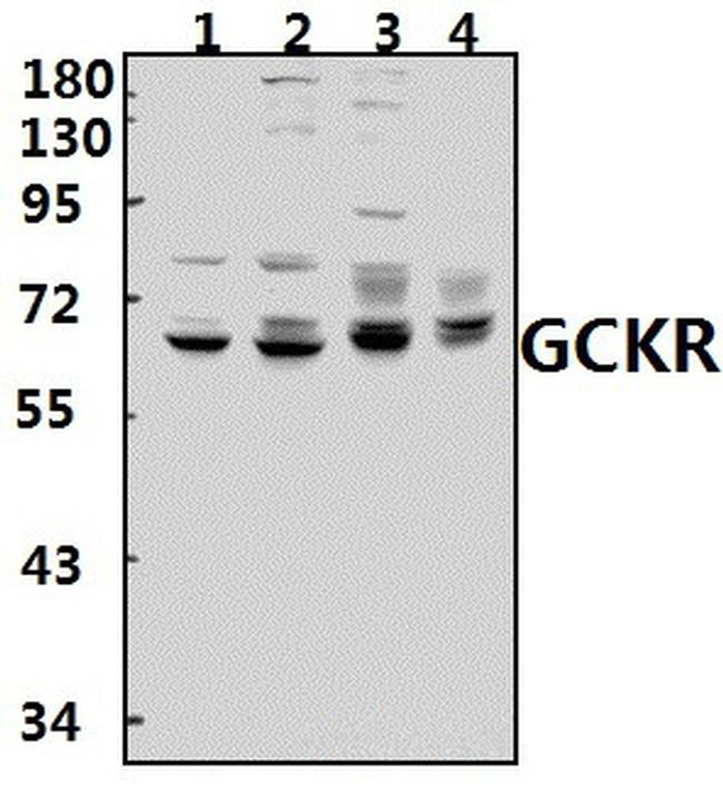 GCKR Antibody in Western Blot (WB)