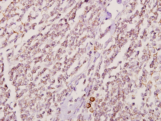 GK2 Antibody in Immunohistochemistry (Paraffin) (IHC (P))