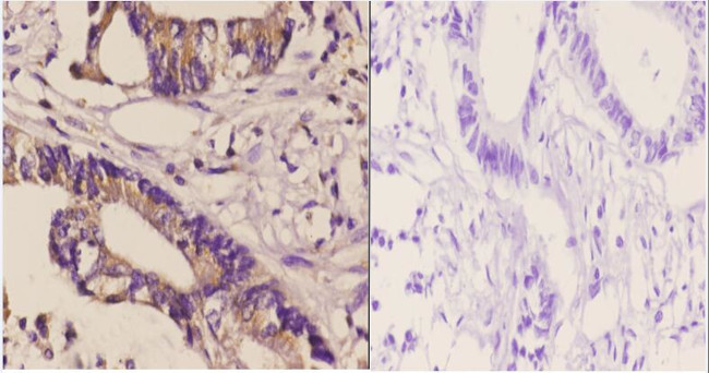 DGKD Antibody in Immunohistochemistry (Paraffin) (IHC (P))