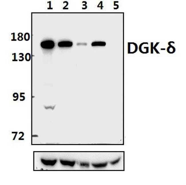 DGKD Antibody in Western Blot (WB)
