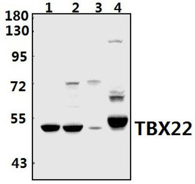 TBX22 Antibody in Western Blot (WB)