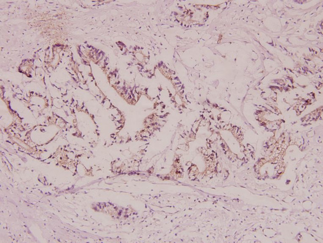 CYP21A2 Antibody in Immunohistochemistry (Paraffin) (IHC (P))