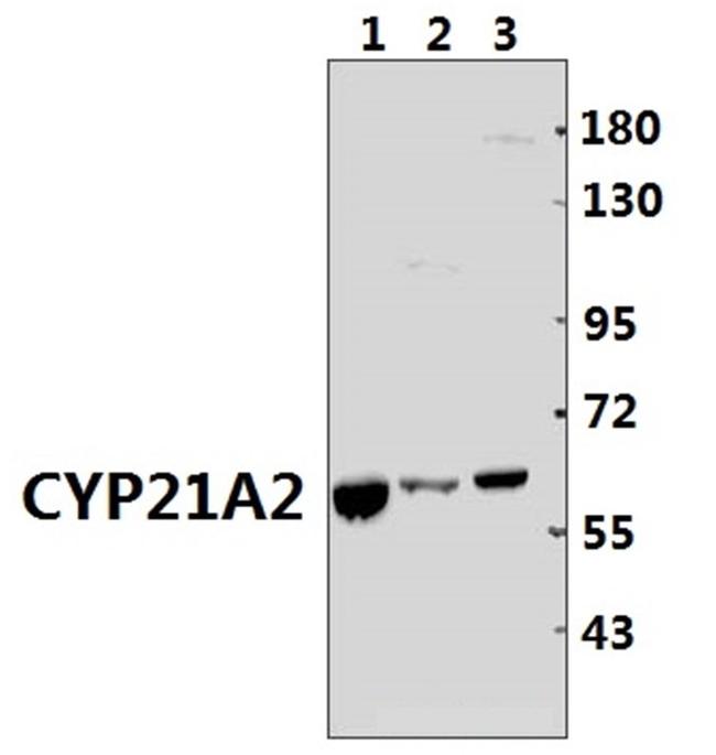 CYP21A2 Antibody in Western Blot (WB)