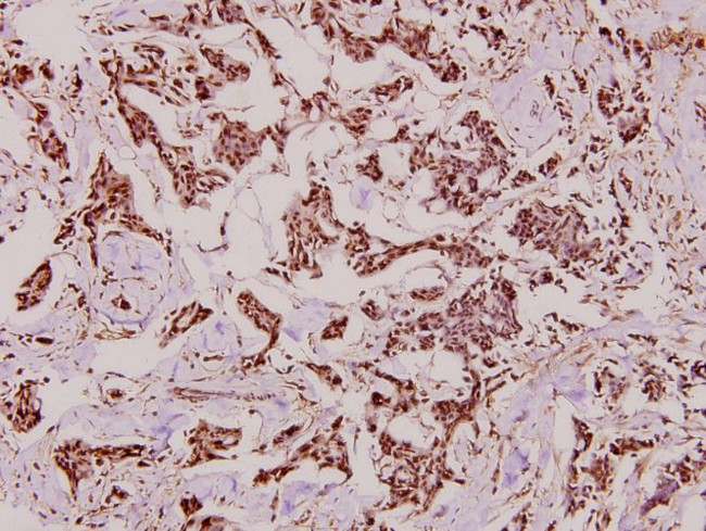 CYP27A1 Antibody in Immunohistochemistry (Paraffin) (IHC (P))