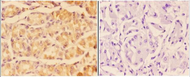 Adenylate Cyclase 5/6 Antibody in Immunohistochemistry (Paraffin) (IHC (P))