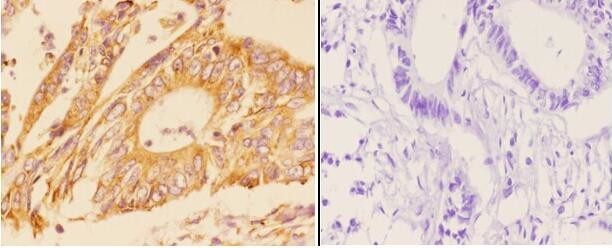 Adenylate Cyclase 5/6 Antibody in Immunohistochemistry (Paraffin) (IHC (P))