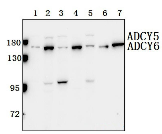 Adenylate Cyclase 5/6 Antibody in Western Blot (WB)