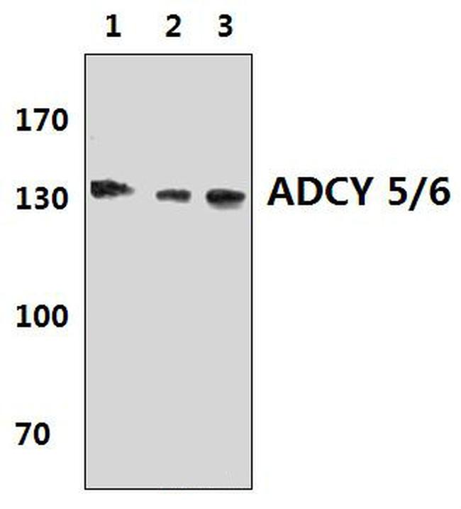 Adenylate Cyclase 5/6 Antibody in Western Blot (WB)