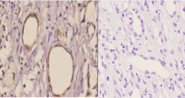 TANK Antibody in Immunohistochemistry (Paraffin) (IHC (P))