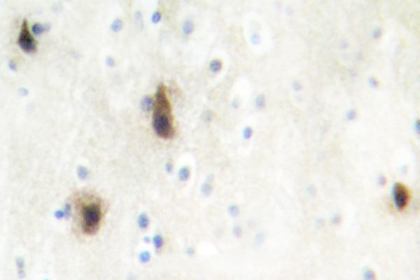 MVK Antibody in Immunohistochemistry (Paraffin) (IHC (P))