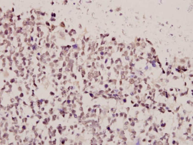 FOXE3 Antibody in Immunohistochemistry (Paraffin) (IHC (P))