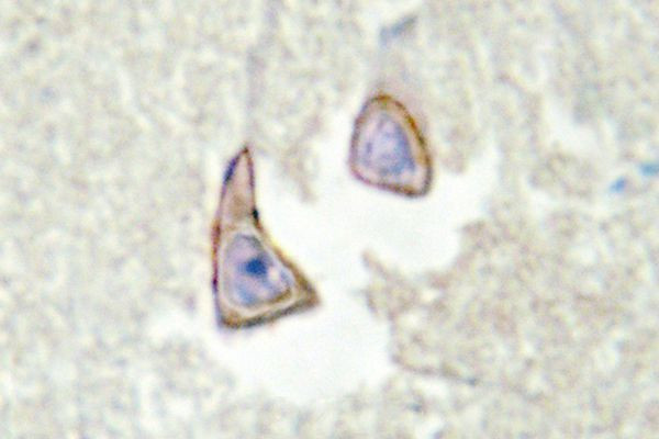 KSR2 Antibody in Immunohistochemistry (Paraffin) (IHC (P))