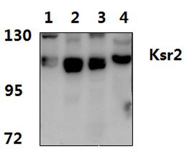 KSR2 Antibody in Western Blot (WB)