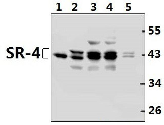 HTR4 Antibody in Western Blot (WB)