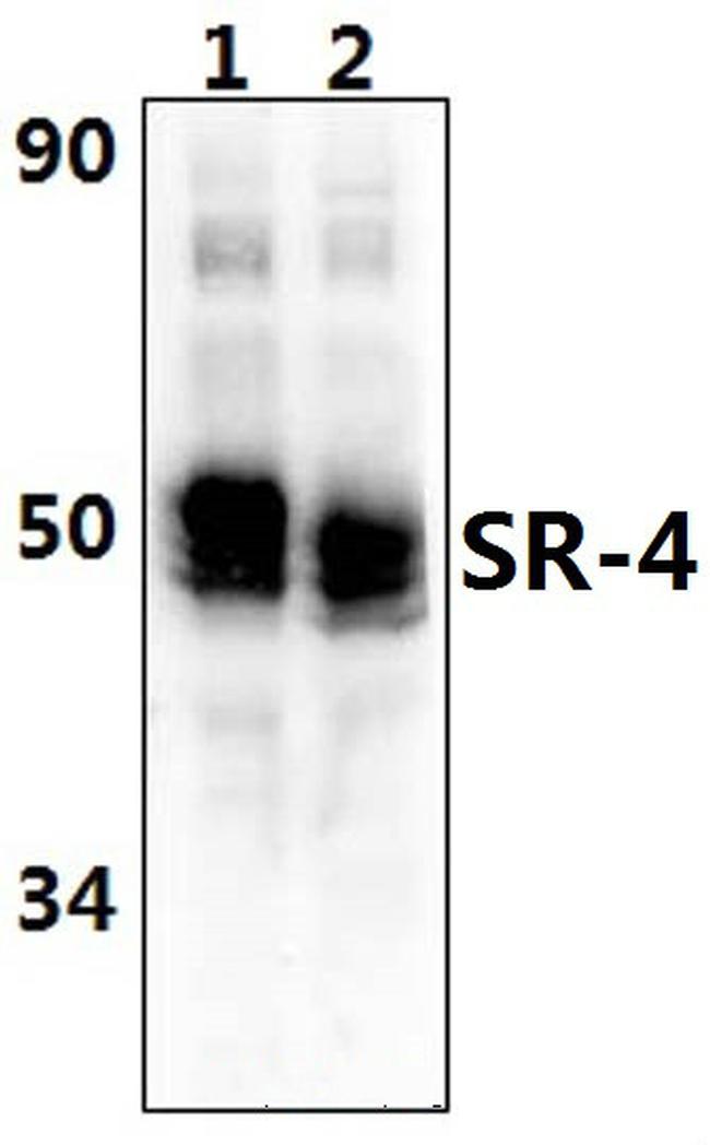 HTR4 Antibody in Western Blot (WB)