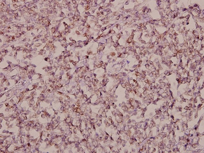 SALF Antibody in Immunohistochemistry (Paraffin) (IHC (P))