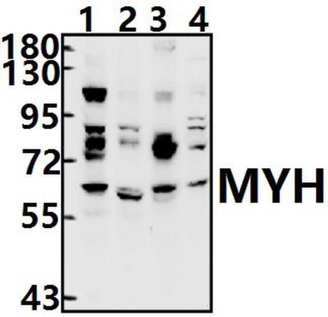 MUTYH Antibody in Western Blot (WB)