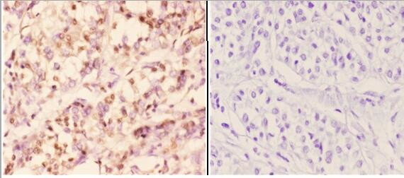 RAD51B Antibody in Immunohistochemistry (Paraffin) (IHC (P))