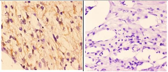 RAD51B Antibody in Immunohistochemistry (Paraffin) (IHC (P))