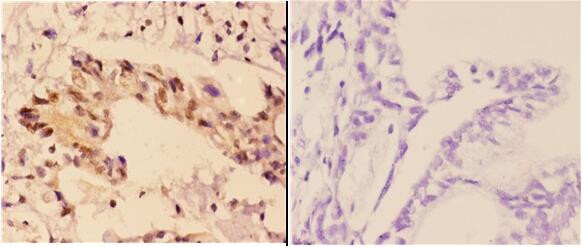 RAD51B Antibody in Immunohistochemistry (Paraffin) (IHC (P))