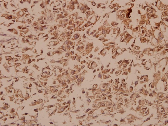 NAB2 Antibody in Immunohistochemistry (Paraffin) (IHC (P))