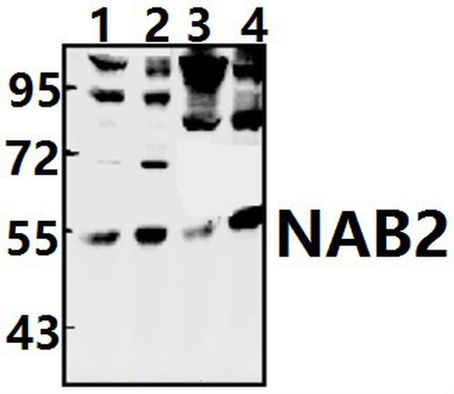 NAB2 Antibody in Western Blot (WB)