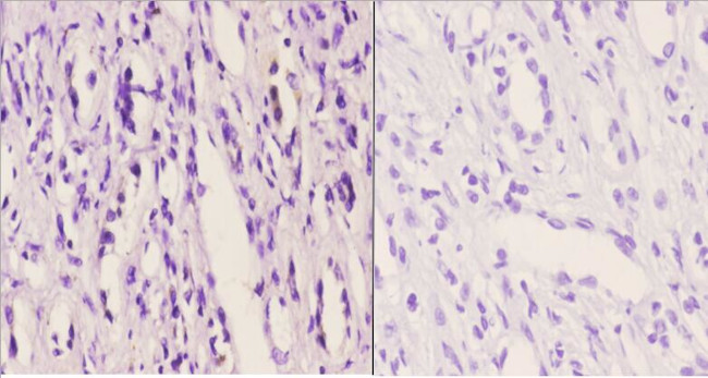 FZD10 Antibody in Immunohistochemistry (Paraffin) (IHC (P))