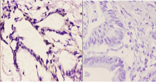 FZD10 Antibody in Immunohistochemistry (Paraffin) (IHC (P))