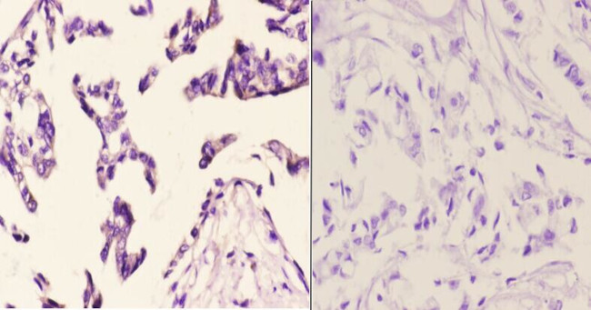 FZD10 Antibody in Immunohistochemistry (Paraffin) (IHC (P))