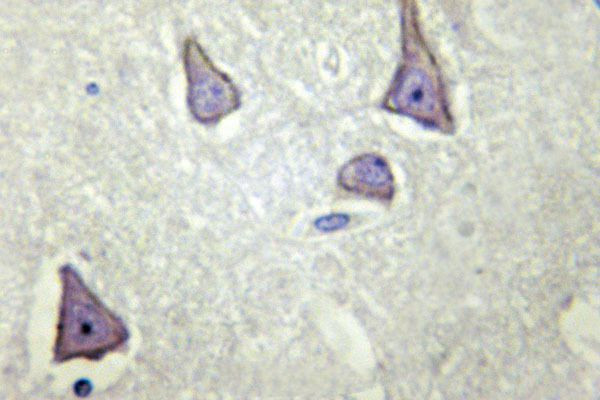 Kir6.2 (KCNJ11) Antibody in Immunohistochemistry (Paraffin) (IHC (P))