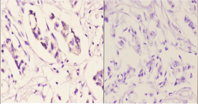 TNFAIP6 Antibody in Immunohistochemistry (Paraffin) (IHC (P))