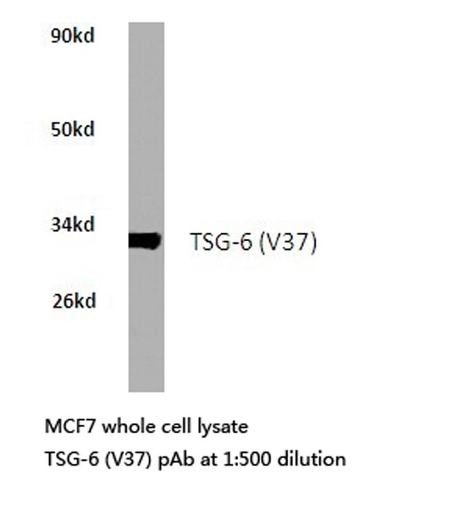 TNFAIP6 Antibody in Western Blot (WB)