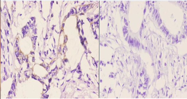 RhoH Antibody in Immunohistochemistry (Paraffin) (IHC (P))