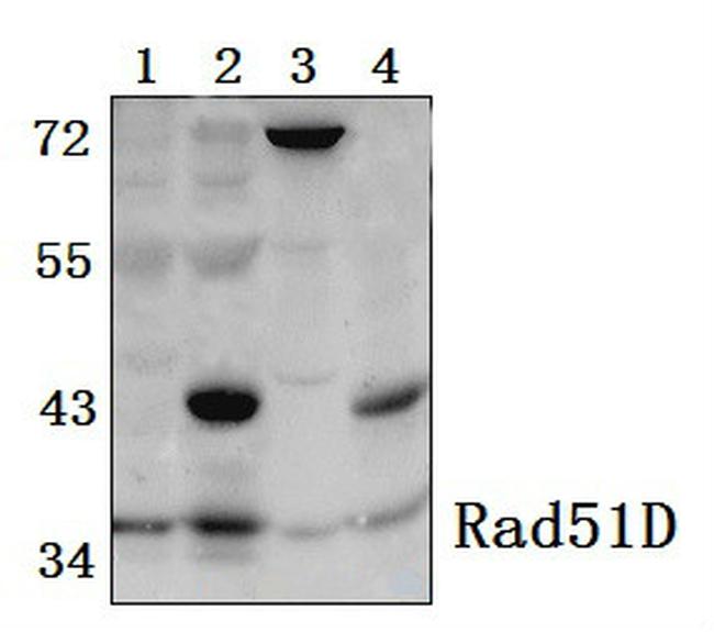 RAD51D Antibody in Western Blot (WB)