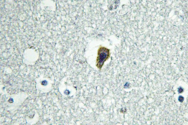 BAI1 Antibody in Immunohistochemistry (Paraffin) (IHC (P))