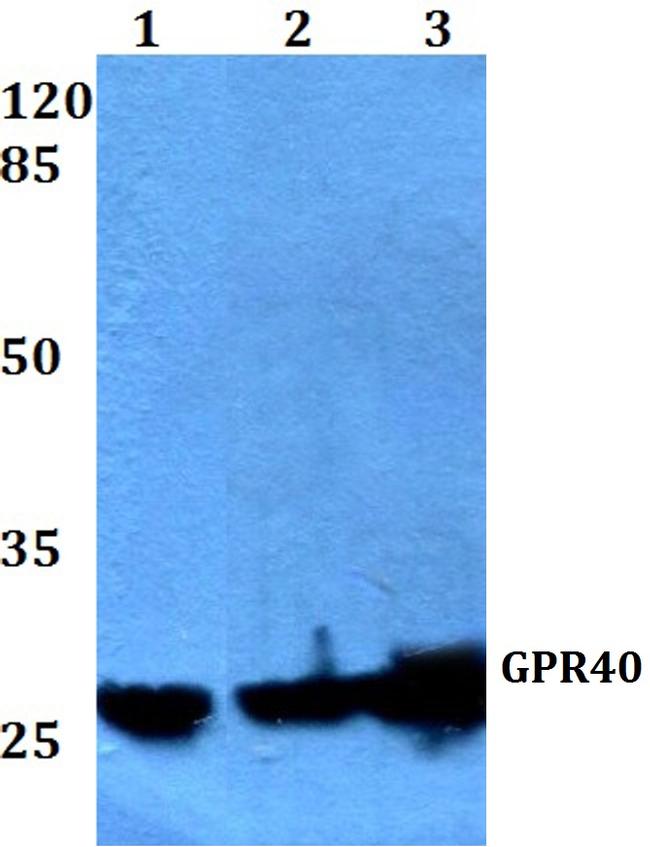 GPR40 Antibody in Western Blot (WB)