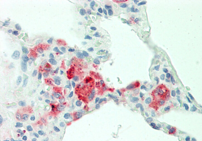 CXCL3 Antibody in Immunohistochemistry (Paraffin) (IHC (P))