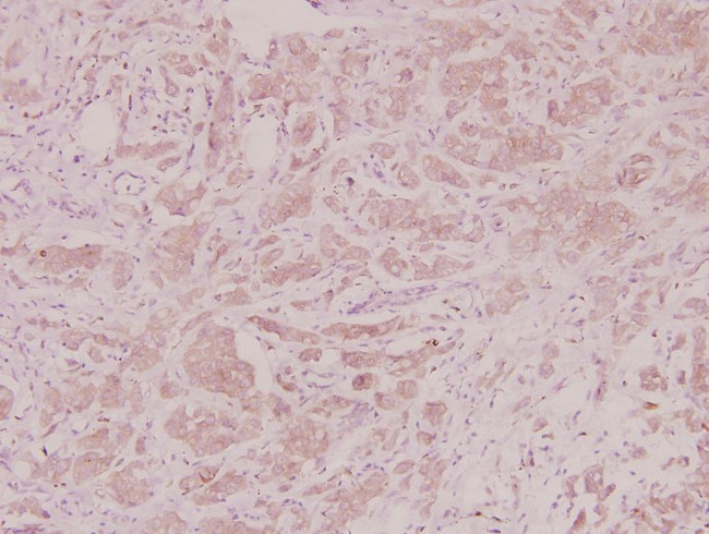 CXCL3 Antibody in Immunohistochemistry (Paraffin) (IHC (P))