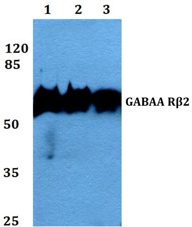 GABRB2 Antibody in Western Blot (WB)