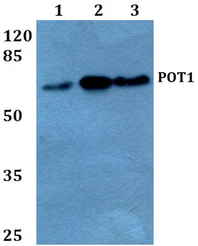 POT1 Antibody in Western Blot (WB)