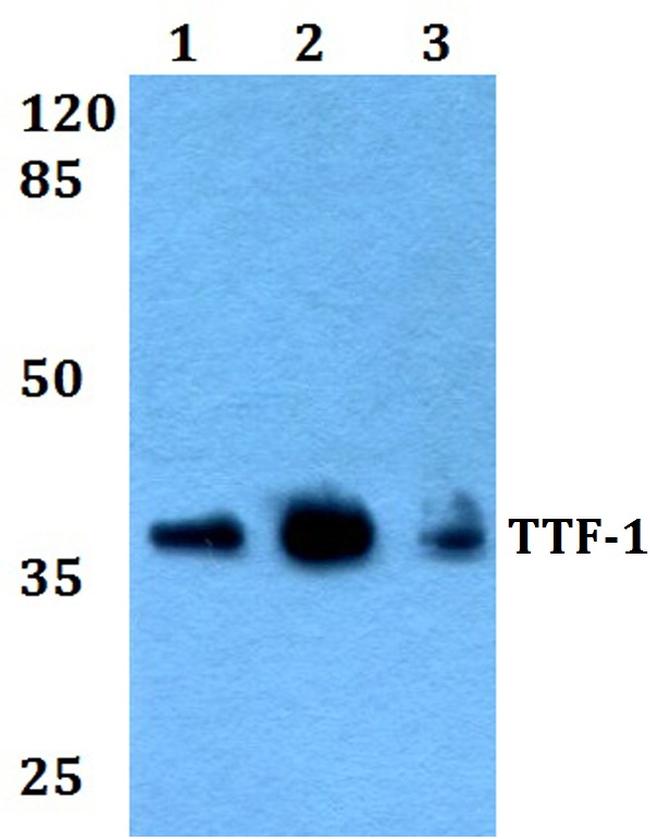 Nkx2.1 Antibody in Western Blot (WB)