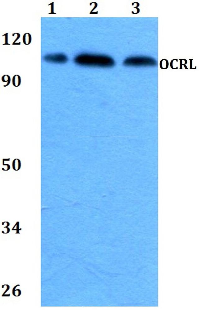 OCRL Antibody in Western Blot (WB)