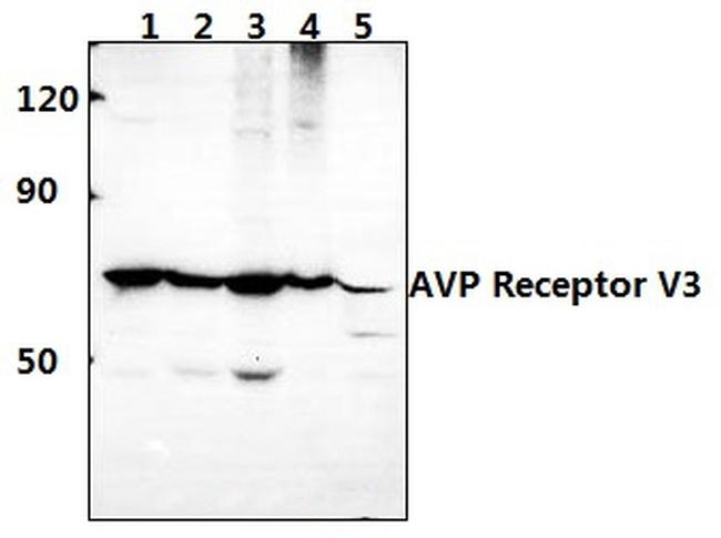 AVPR1B Antibody in Western Blot (WB)