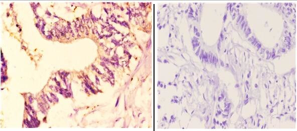 CYP7B1 Antibody in Immunohistochemistry (Paraffin) (IHC (P))