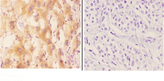 CYP7B1 Antibody in Immunohistochemistry (Paraffin) (IHC (P))