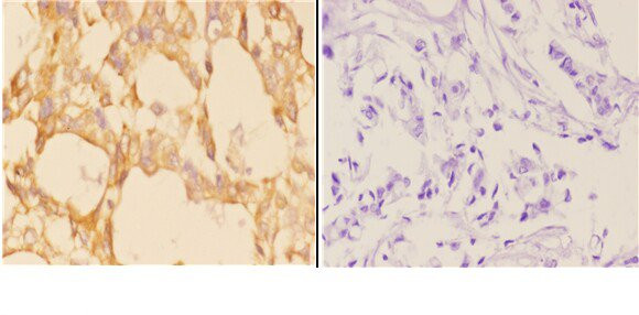 ABCB10 Antibody in Immunohistochemistry (Paraffin) (IHC (P))