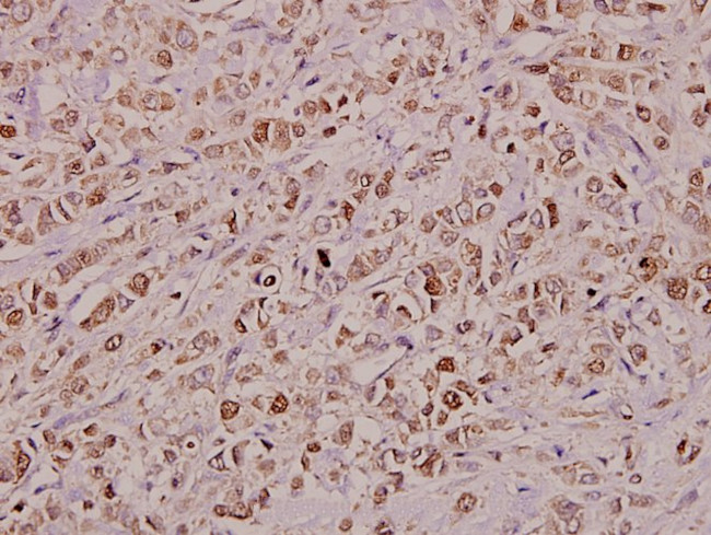 KDELR2 Antibody in Immunohistochemistry (Paraffin) (IHC (P))