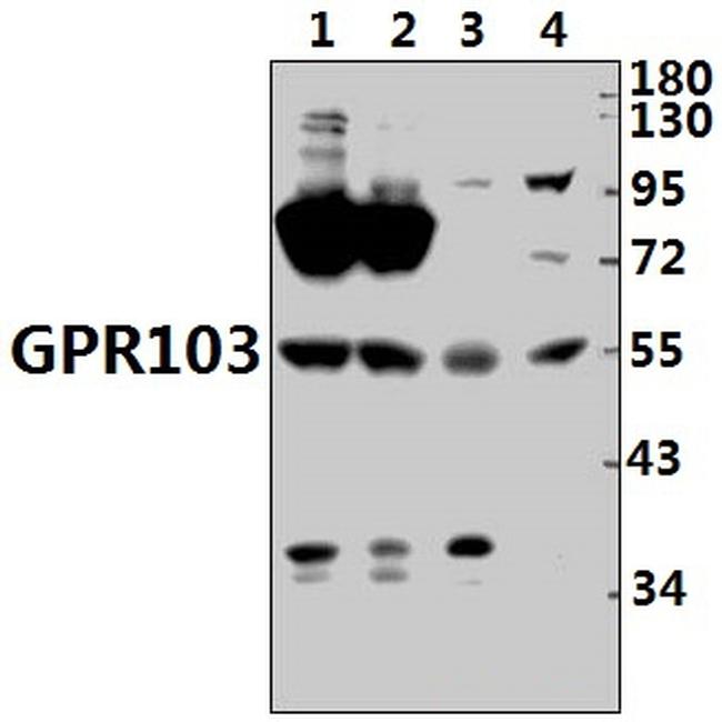QRFPR Antibody in Western Blot (WB)