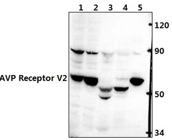 AVPR2 Antibody in Western Blot (WB)