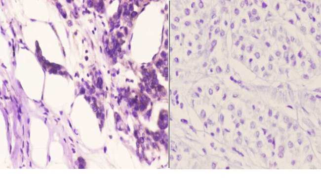 OXER1 Antibody in Immunohistochemistry (Paraffin) (IHC (P))